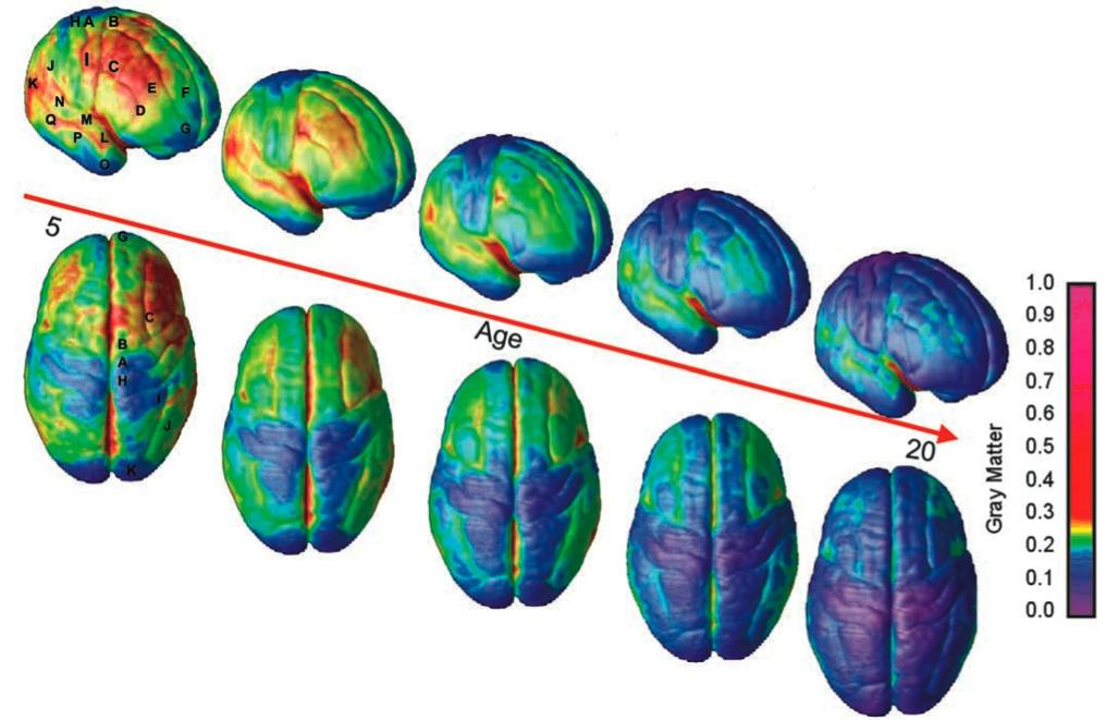 智商高低是因为思维习惯不同造成的吗？配图