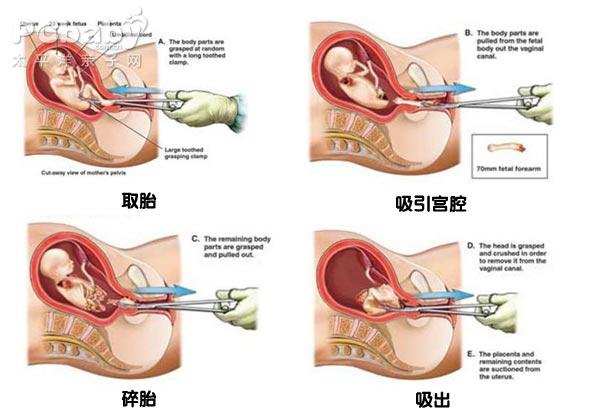 早恋是否有错,为何没有看见国外抑制早恋的报道?配图